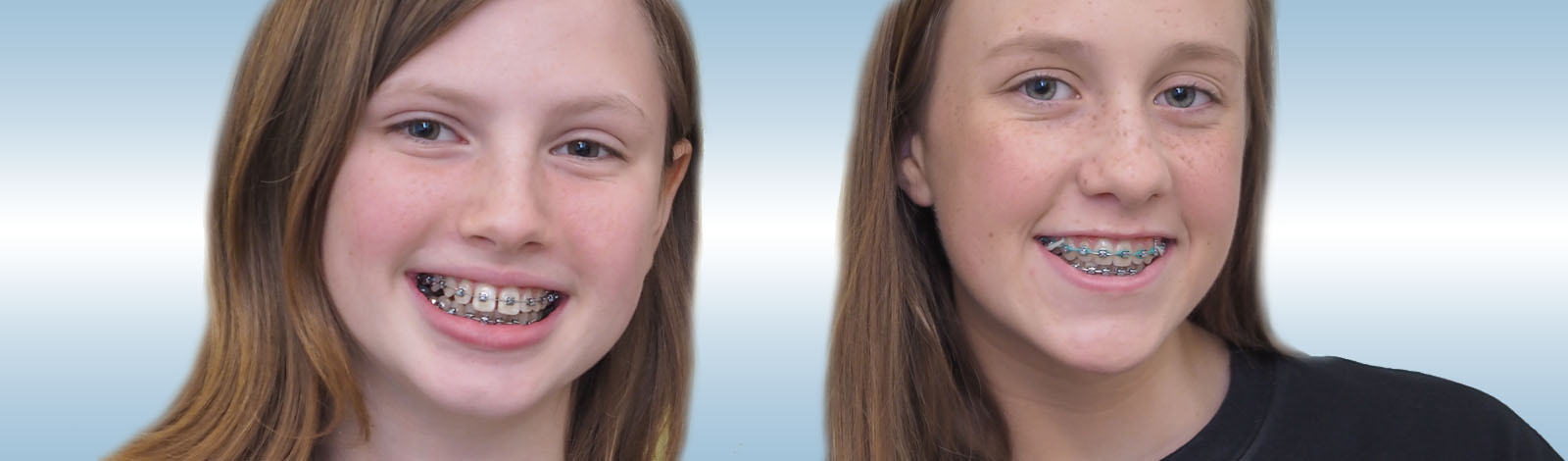 Faust Orthodontics Havertown Pa